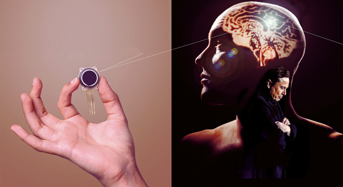 Neurotechnology: First Human Chip Implant